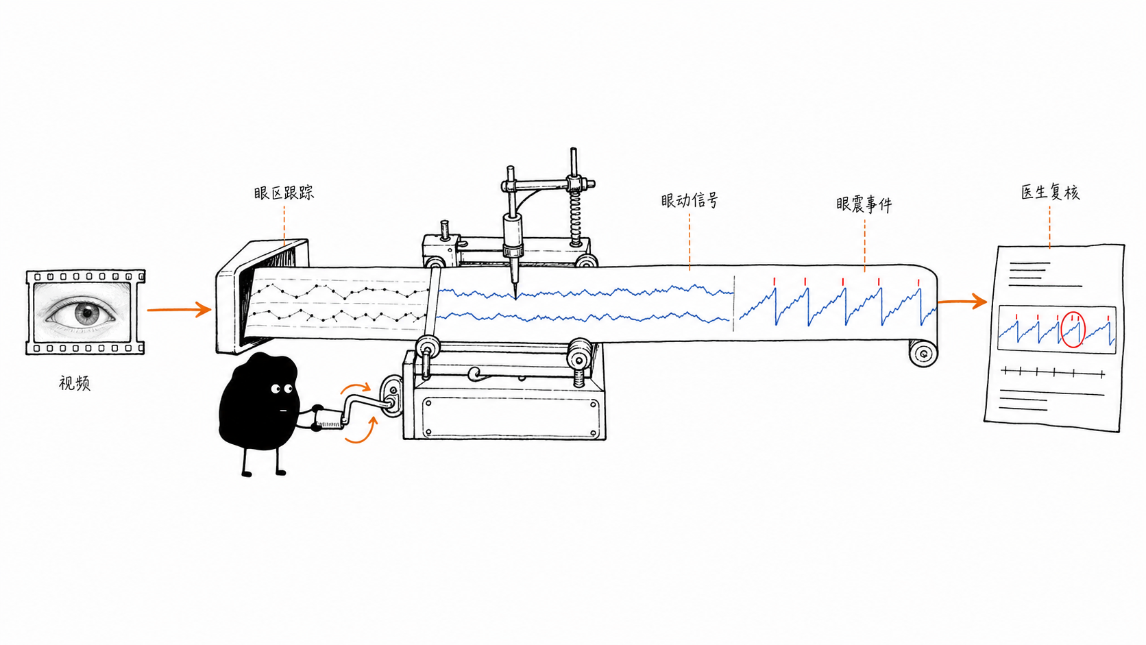 CV 眼震检测 Pipeline